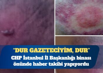 Gazeteci Fatoş Erdoğan: İl başkanlığından üç plastik mermi morluğuyla eve döndüm