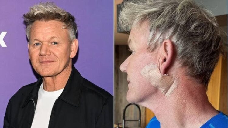 Dünyaca ünlü şef Gordon Ramsay hastalığını ilk kez açıkladı
