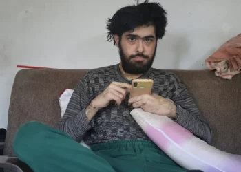 Depremden sonra kendini eve kapattı: Telefon bağımlısı genç ne duş alıyor ne de tırnaklarını kesiyor