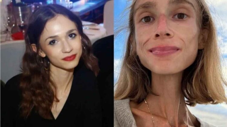 Meyve diyeti fenomenin sonu oldu