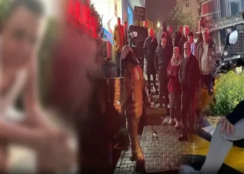 Kuaförde dehşet: 14 yaşındaki çocuğun tüm vücudu yandı