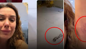 Dilan Polat en yakınından tekme tokat dayak yedi