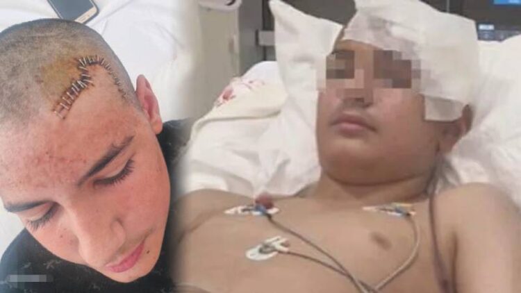 Konya’da akran şiddeti: 13 yaşındaki çocuğun kafatası taşla kırıldı, serbest bırakılan saldırgan “baba tahliye” paylaşımı yaptı