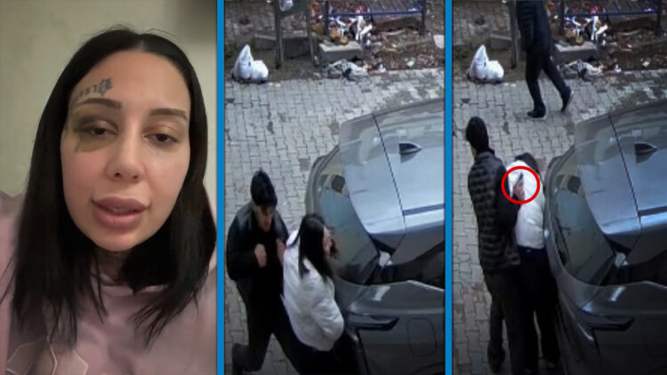 Boşanma aşamasındaki eşi tarafından silah çekilip darbedilen Yağmur: Hamile kaldım, evlendik, şiddet başladı