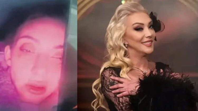 Güllü’nün kızı “Annem beni dövdü” deyip kanlar içinde video paylaşmış: Sinir krizi geçirip kendim yaptım