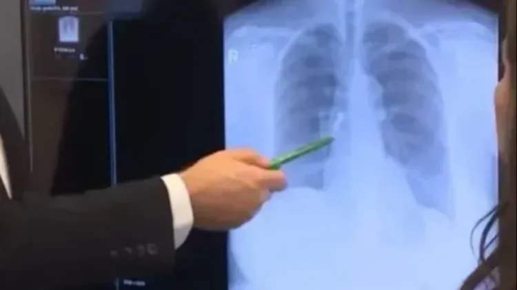 Kaplama dişleri uyurken akciğerine kaçtı