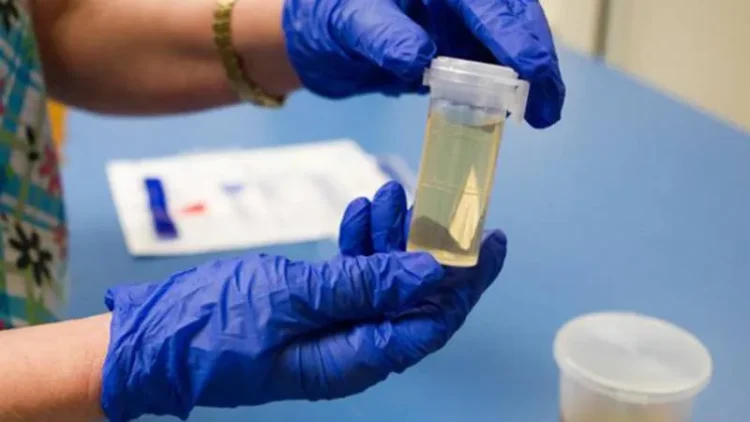 İşe alımlarda “madde testi” dönemi: Stajyerlerden de isteniyor, talep 7 kat arttı