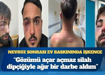 Nevruz sonrası ev baskınında işkence: “Gözümü açar açmaz silah dipçiğiyle ağır bir darbe aldım”