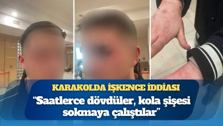 Kadıköy’de karakolda işkence iddiası: Saatlerce dövdüler, kola şişesi sokmaya çalıştılar 